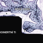 Bioinertní titan