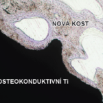 Osteokonduktivní titan